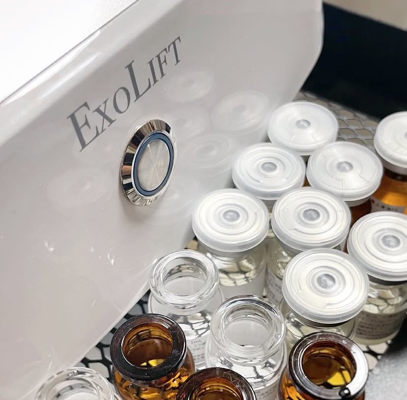 エクソリフト施術